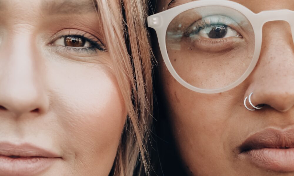 Two woman with Alopecia Areata