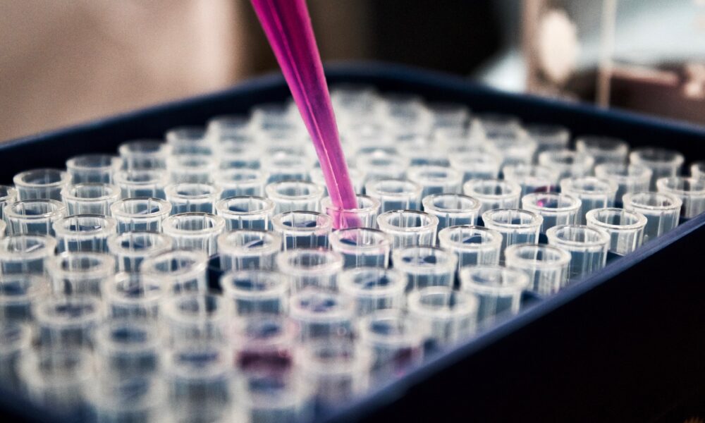 Test tubes in a container.
