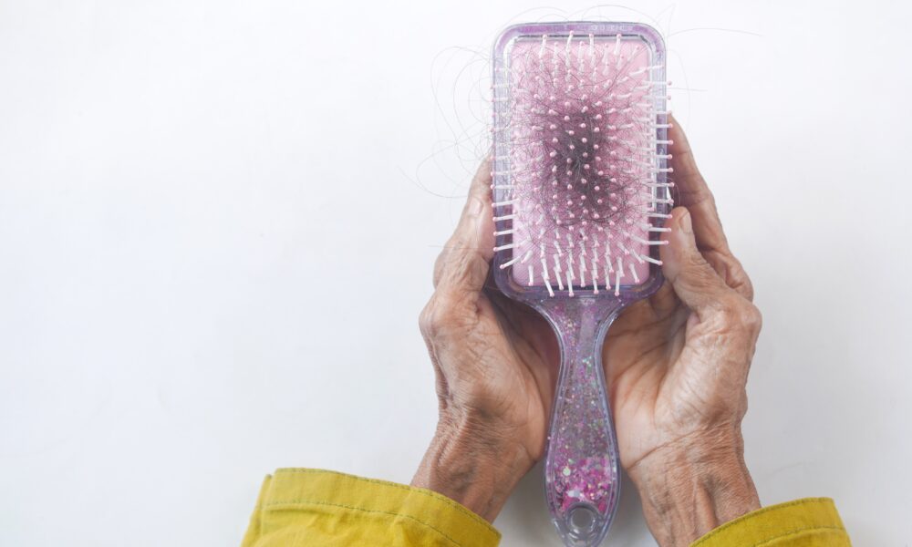Hands holding a brush full of hair.