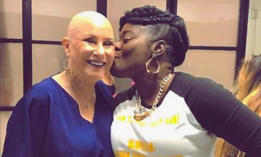 Woman with alopecia gets kiss on the cheek.